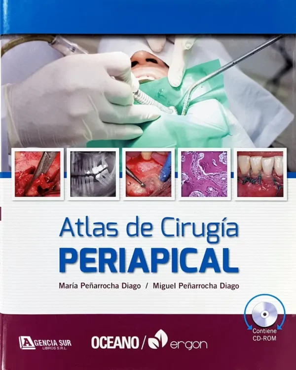 Atlas de CIRUGÍA PERIAPICAL