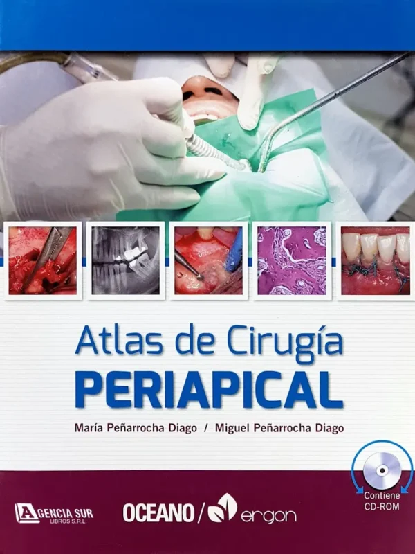 Atlas de CIRUGÍA PERIAPICAL