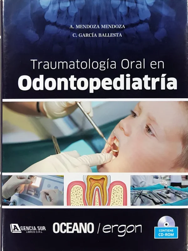 Traumatología Oral en ODONTRPEDIATRIA