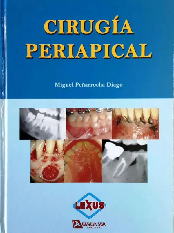 CIRUGÍA PERIAPICAL